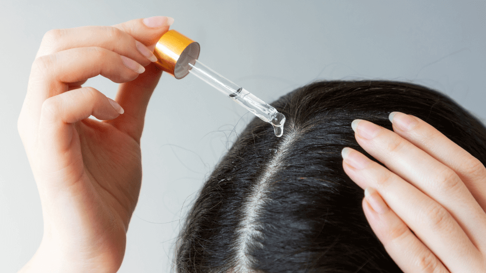 Applying hair oil with a dropper to scalp for hair loss prevention and improved hair growth.